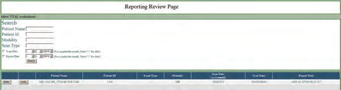 Fönstret Review (granska) (endast VitreaWorkstation) Använd fönstret Review (granska) för att visa rapporter som anslagits på intranätet.
