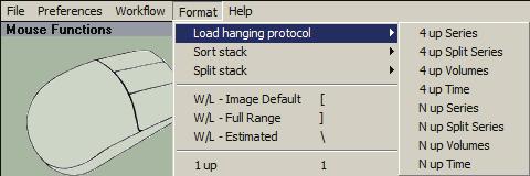 Format-menyn - Load hanging protocol (ladda anpassat protokoll): c. Välj protokollet N up Time (n upp tid).