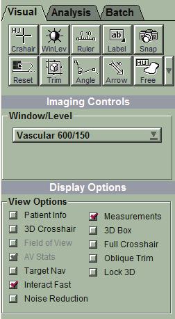 Kontroller på fliken Visual (visuellt) På fliken Visual (visuellt) i visningsfönstret kan du ändra bildbehandlingskontroller eller ställa in visningsalternativ.