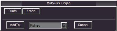 TIPS Vid behov klickar du på listrutepilen och väljer knappen Organ. Ett grönt överlägg visas runt markören. OBS! Det går att utföra organsegmentering i oblikt MPR-läge.