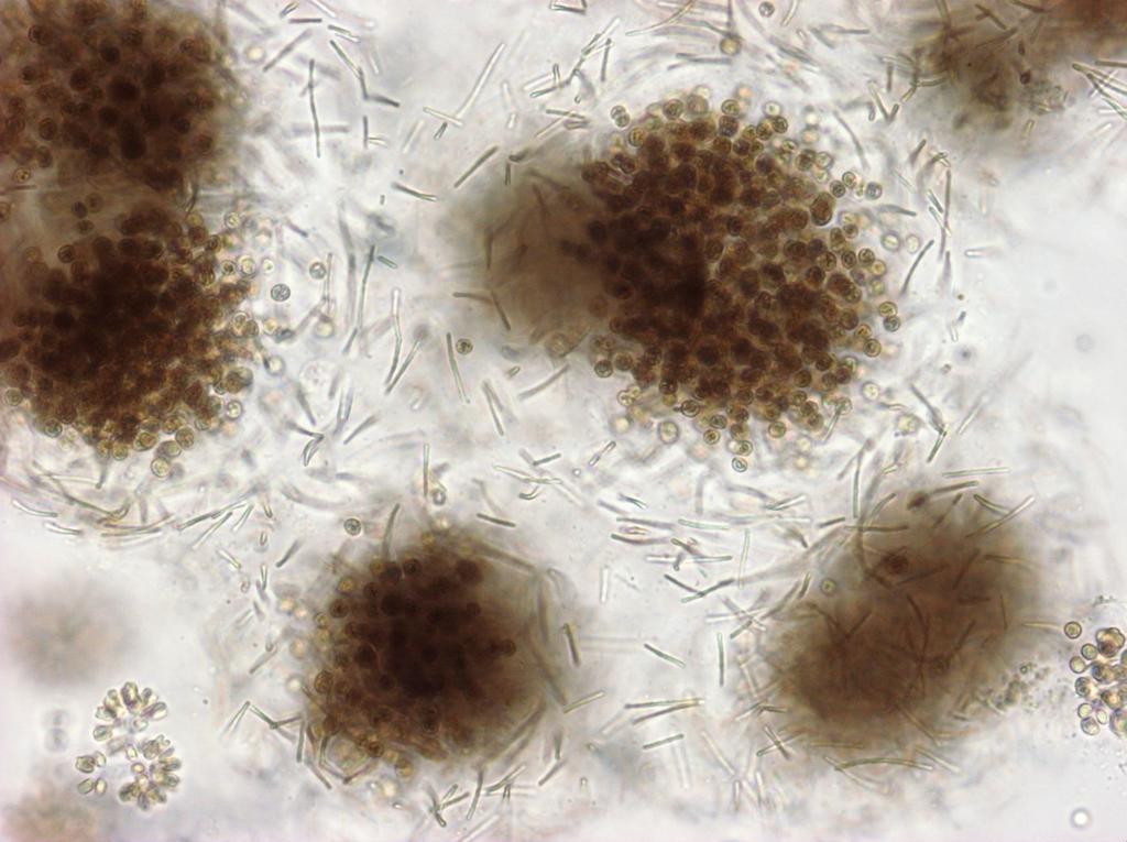 visats leva associerade med Microcystis i cyanobakteriens geléskikt i Finjasjön (Annadotter med flera, 26) (Figur 49).