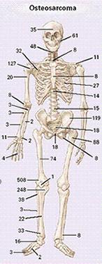 Prox tibia 3. Humerus 4. Bäcken 5. Prox femur 6.