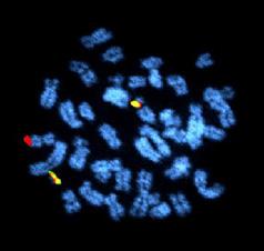 Kvantitativ RT-PCR PCR Translokationer: Mutationer: Chimerismanalys: