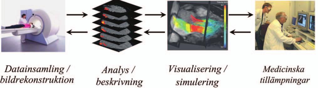 Figur 1 CMIV bedriver forskning inom alla delar av undersökningskedjan Figur 2 fmri-bild som visar aktiveringen i hjärnans motorarea Forskningsprojekt Forskningen inom CMIV spänner över flera olika