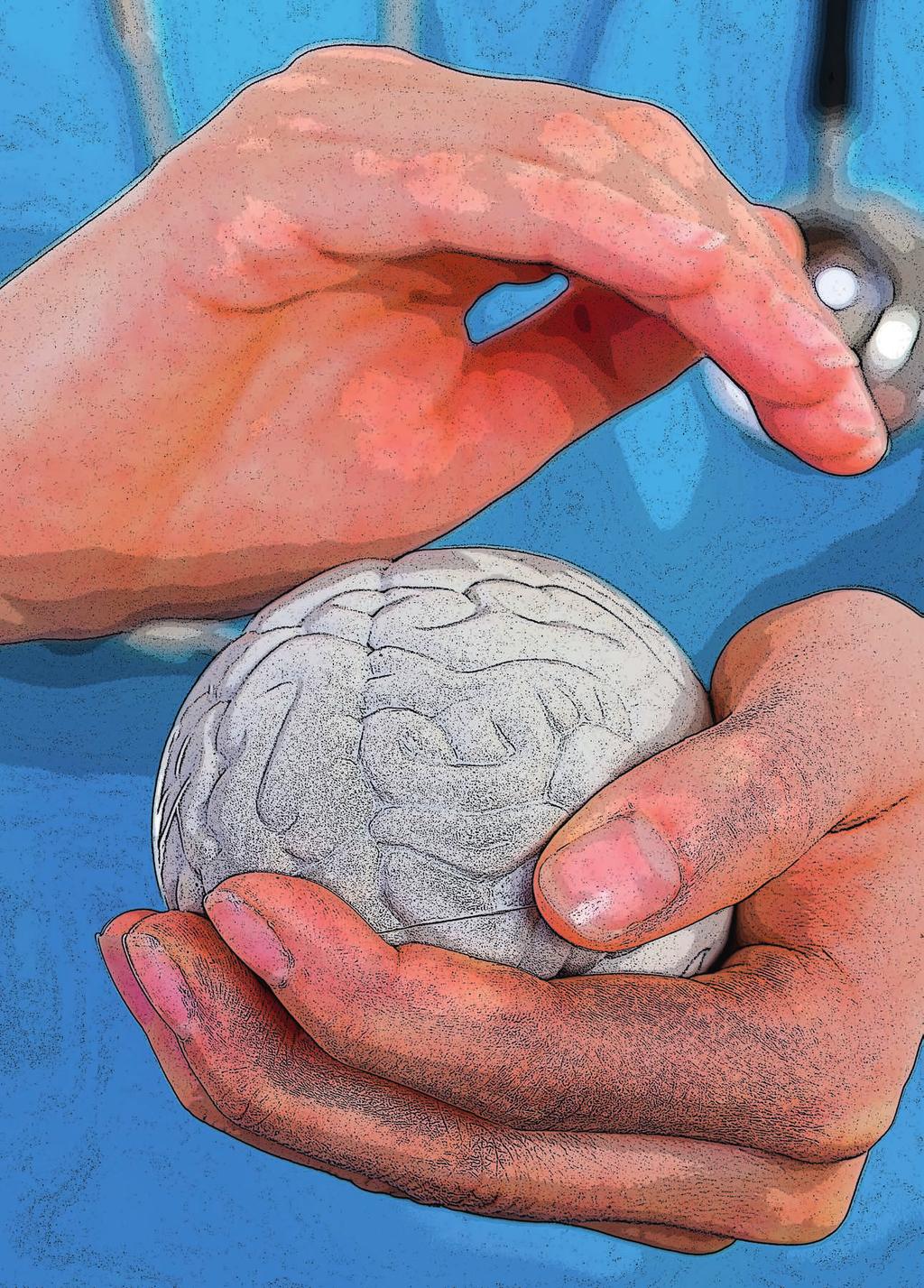 62 neurologi i