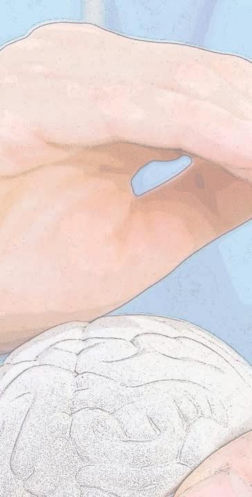 systematrofi (MSA) Neurodegeneration med järnackumulering i hjärnan Geriatrisk depression