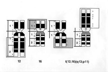 FAKTARUTA 4 i maligna ben- och mjukdelstumörer Liposarkom Myxoid och rundcellig t(12;16)(q13;p11) CHOP/FUS t(12;22)(q13;q12) CHOP/EWS Högt differentierat +r(12) Synovialt sarkom t(x;18)(p11;q11)