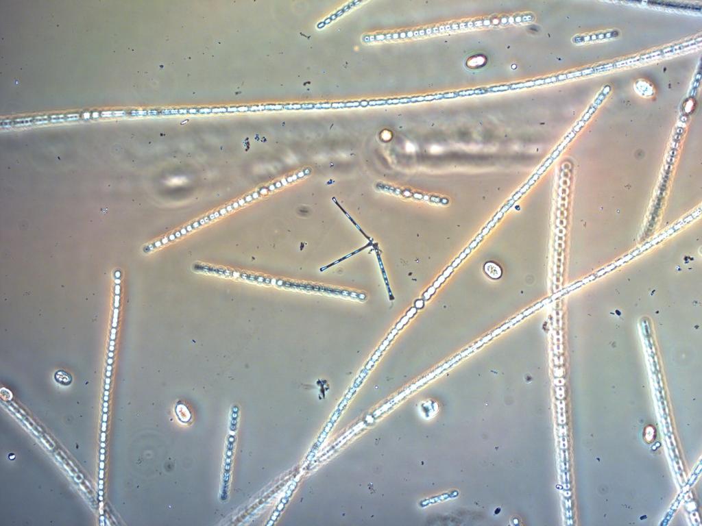 Asterionella