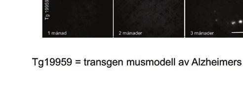 1b) Visar intilligande histologiska snitt infärgade med thioflavins (ThS) som binder in till amyloida strukturer. Här ser vi att ThS först ger signal i tre månader gamla transgena möss.