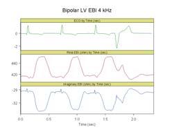 Mera formler Bipolar LV-Z Z (RV ring - LV ring) C4 Biologisk vävnad: Z = R + 90 < ϕ < 0 < 0 j = reaktans ϕ = fasvinkel Anesthetized subject, 38 kg