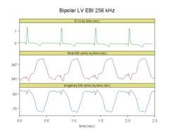 EBI of the Heart s Myocardium Complex impedance Z=R+j Low frequency electrical current passes mostly around the cells (unbroken arrow) At high