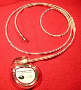 Implantable LAP sensor trans-septal approach