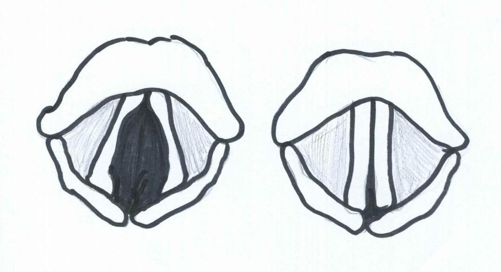 vuxen kvinna ca 9-13 mm och 15-20 mm hos en man (Sundberg, 2007). Springan mellan dessa kallas glottis. Bild 3. Till vänster: Stämband i abducerat läge. Till höger: Stämband i adducerat läge. 2.1.3 Ansatsrör De hålrum som finns från glottis och upp till läppöppning kallas för ansatsrör.