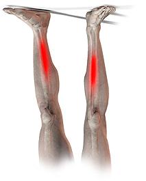 Benhinneinflammation Smärta på insidan av skenbenet i samband med löp- och hoppträning. Extra vanligt hos distanslöpare.