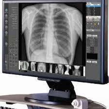 Institutionen för hälsovetenskap Avdelningen för medicinsk vetenskap Studiehandledning M0057H Radiografi med inriktning mot