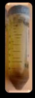 DNA analys Prov DNA extraction DNA blandning PCR amplifiering P1
