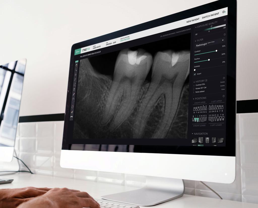 Vill du ha ett intelligent och användarvänligt system? Onepix är Skandinaviens mest populära kliniska bildhanteringssystem och används idag i över 7 000 behandlingsrum runtom i Skandinavien.