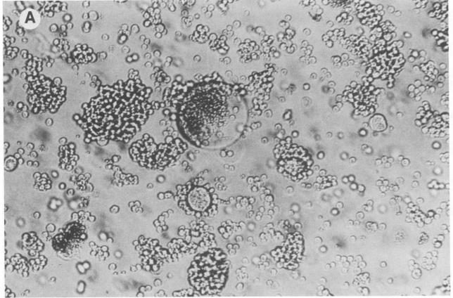 rapid/high syncytia inducing (SI) T-cell