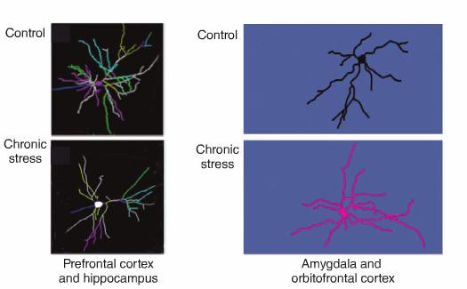 Förtunnad hjärnbark vid kronisk stress Strukturella hjärnförändringar vid