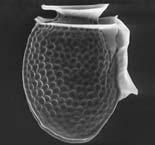 n Bilderna visar dinoflagellaterna Dinophysis acuta,
