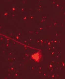 Allt större mellanårsvariation MILJÖÖVERVAKNING 27 bakterieplankton Johan Wikner, Umeå universitet Bottniska viken Mellanårsvariationen i bakterieförekomst har ökat markant från perioden 1991 1998