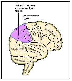 Kognitiva neuropsykologiska praxissystemet Sensoriska/Perceptuella systemet Analysera visuella gester och information kring föremål Begreppssystemet Kunskap om handlingar, rörelser och föremål