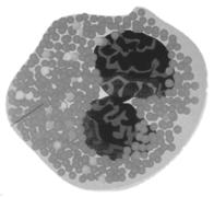 Blod & thymolymfatiska organ (GS) 1. Transplantationsantigenet MHC-I förekommer på de flesta celler i kroppen. Vilken av blodcellerna saknar dock MHC? (0,5 p) SVAR: röda blodkroppar 2.