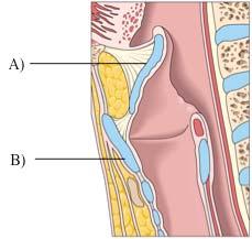 Respiration 2p (anatomi) (GSL) 16. Vad heter larynxbrosken A respektive B på bilden nedan?