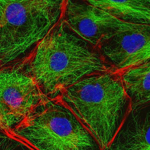 Cellskelettet (cytoskelett) Cellplasman genomkorsas av ett system av tunna proteintrådar som tillsammans