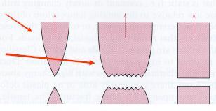 Typer av fraktur Skillnaden illustreraras nedan: (a) mycket smidig fraktur (b) något smidig fraktur (c) totalt skör fraktur