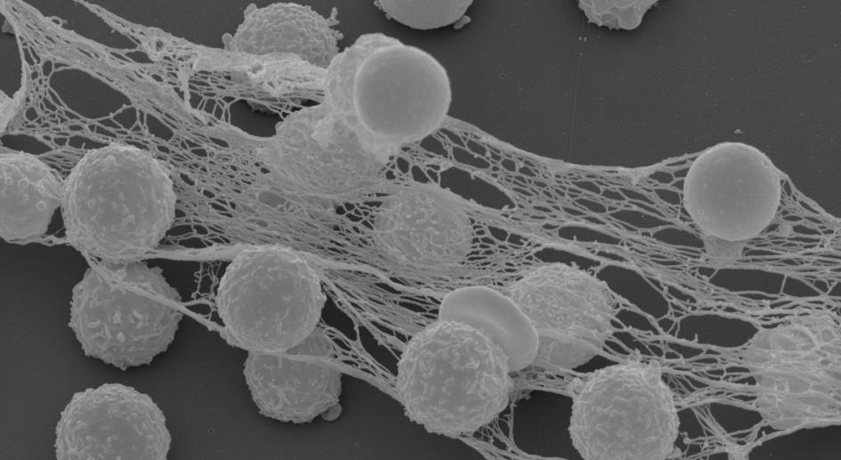 Neutrophil extracellular traps (NETs) Neutrofilernas dynamik repetition av lite siffror Hos en vuxen bildas ~10 11 (100 Gig)