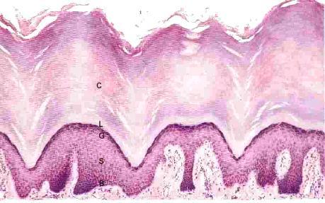 Allmänt: - Granska epitelet på läppens yttre och inre yta. Av håren kan du sluta dig till vilken sidan som är vilken. Det är fråga om två variationer av samma epiteltyp. Bestäm typ på epitelet.