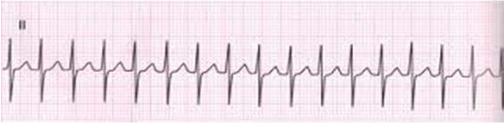 EKG (5p) 24.