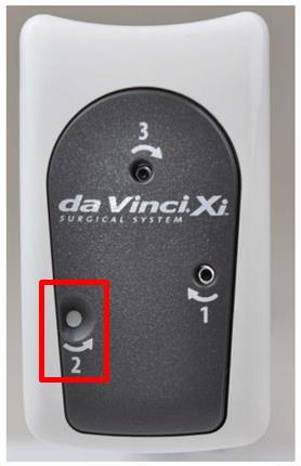 Bilaga A Denna bilaga avser att betona vikten av korrekt användning av da Vinci Xi EndoWrist lösgöringssats för Stapler (SRK).