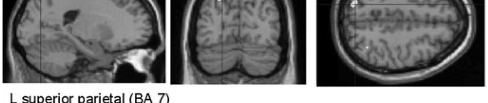 Parietal cortex