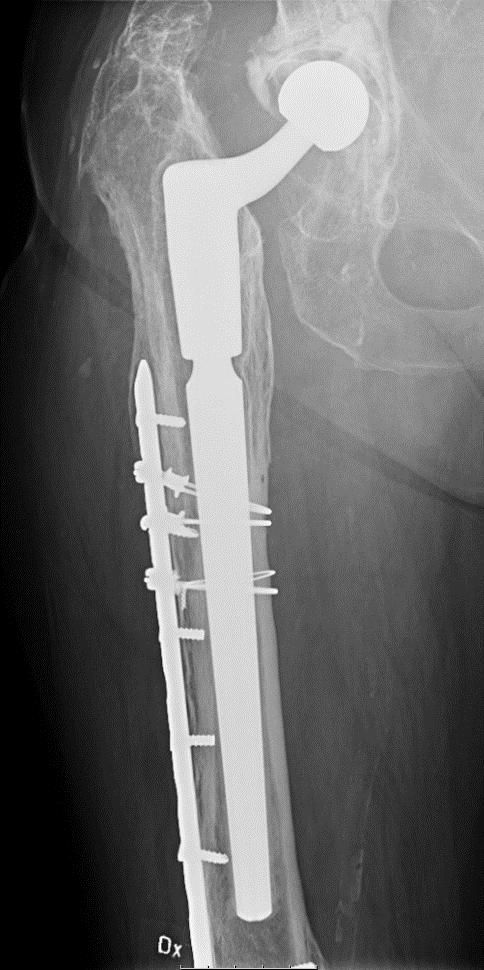 PET-CT