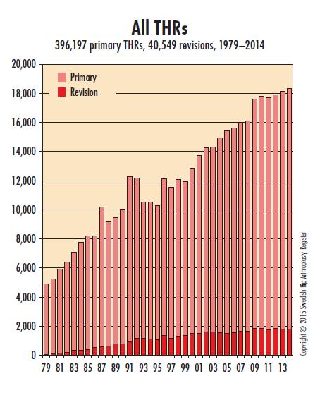 Antal total höftartroplastik i Sverige 1979-2014; primär operation och revisioner Ref. Svenska höftartroplastik registret.