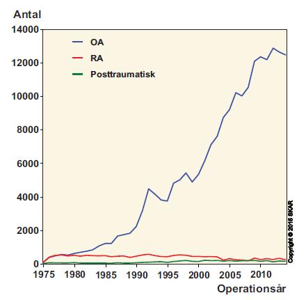 Antal knäprotesoperationer i Sverige 1975 2014: uppdelad efter diagnos Ref. Svenska knäartroplastik registret.