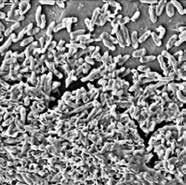 10 Dental plack, urinvägsinfektioner och ögoninfektioner är alla associerade med biofilm.