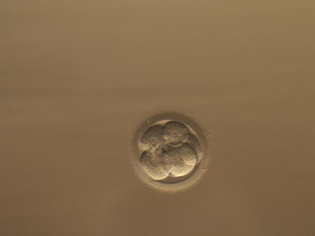 embryon i