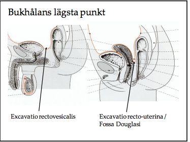 Cisterna chyli samlar ihop lymfa från truncus lumbalis och trunci intestinales.