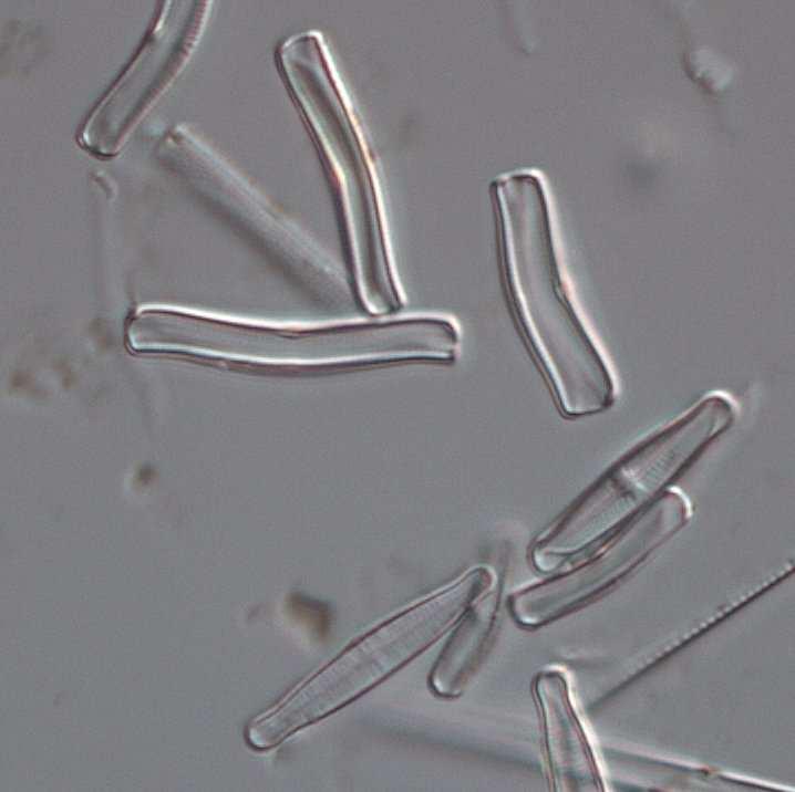 SKRÄBEÅN 2016 Bilaga 5, Kiselalger Figur 22. Förekomsten av artkomplexet Achnanthidium minutissimum (till vänster.) och släktet Eunotia (här representerat av E.