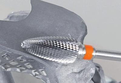 Dentsply presenterar ett nytt höghållfast glaskerammaterial av zirkonium-förstärkt