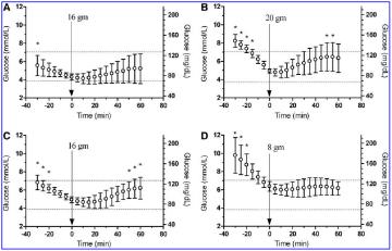 1 CGM Real-time and exercise 1 Förebygg hypoglykemi under fysisk aktivitet Product Interval Trend arrow