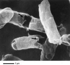 temperature at which all the bacteria in a population will be killed within 10 minutes TDT