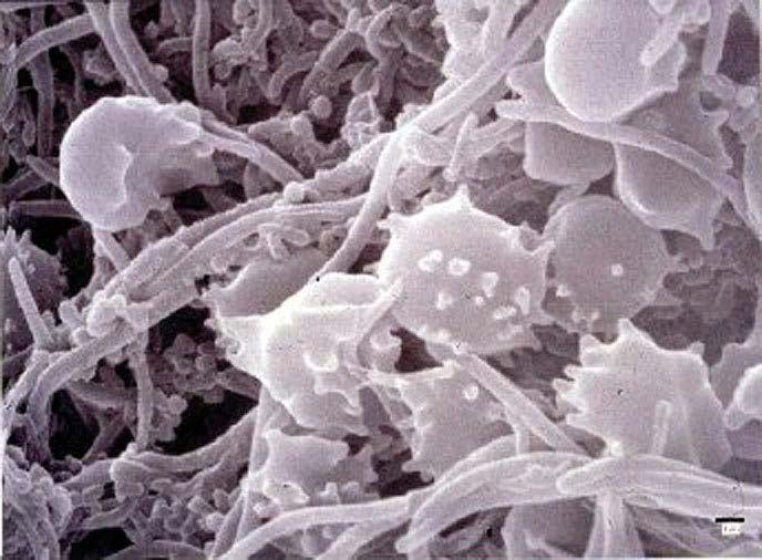 Factors that affect cell death Time Number of cells Type of