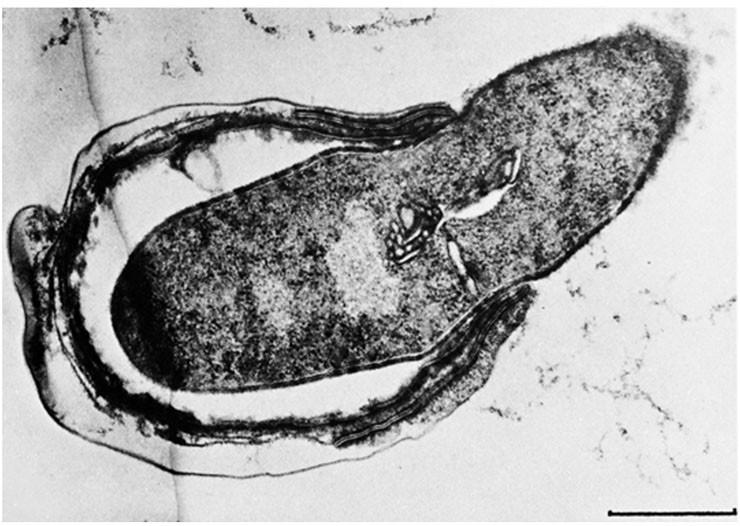 The Bacterial Endospore formed by some bacteria (Bacillus and