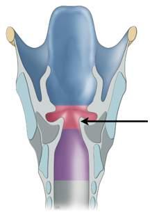 LARYNX: Ange med en pil i bilden nedan var Plica vocalis är belägen. (091130REST, 0,5p) Ökar LARYNX: Larynx olika muskler medverkar på olika sätt larynx ljudbildning.