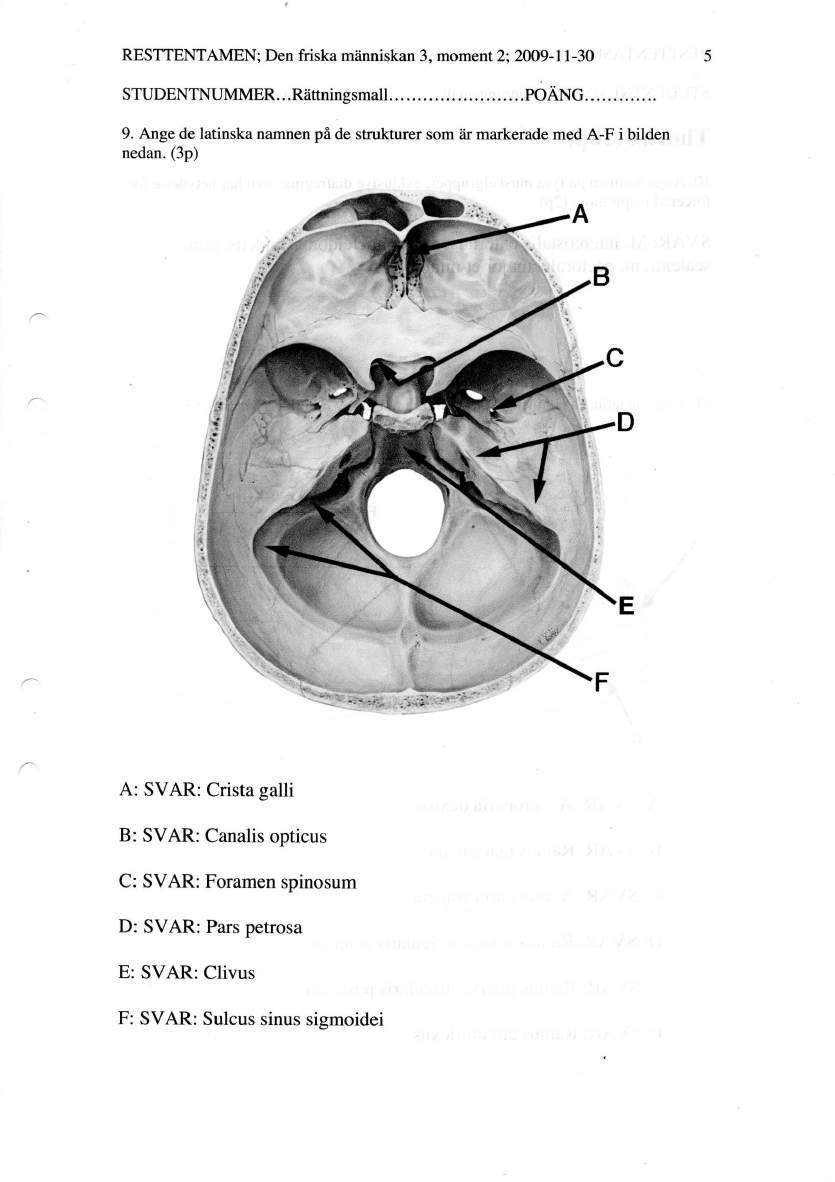 HÅLRUM CRANIUM: Ange de latinska namnen på de strukturer som är markerade med A-F i bilden nedan.