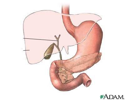 (110211ORD, 3p) ileum är, i jämförelse med jejunum: Vägglagret tunnare Vasa